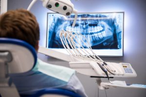 Ząb zatrzymany - pacjent na fotelu dentystycznym oglądający zdjęcie RTG zębów.